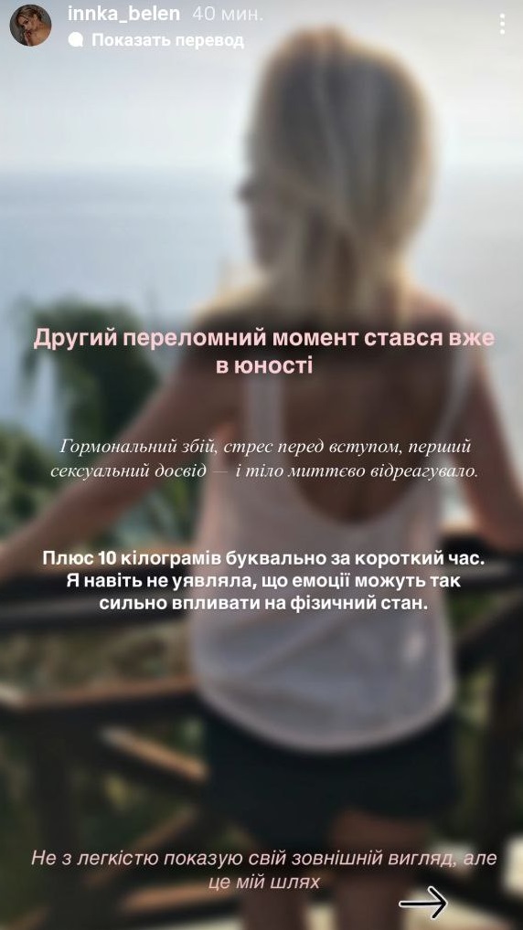 Інна Бєлєнь після "Холостяка" зробила "пластику" грудей і підборіддя